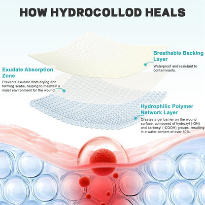Hydrocolloid Roll for Wound Care - Medical Grade Hydrocolloid Bandages with Flexible & Waterproof, Ultra-Thin, Self-Adhesive, DIY Shape & Size Home First Aid Kit Essential (2In*5Ft)